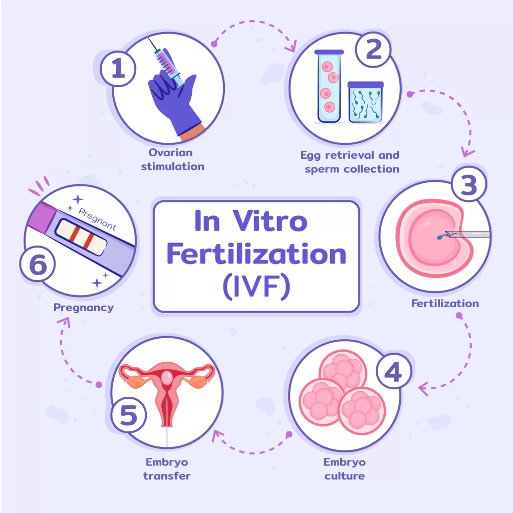 IVF Treatment Procedure - Javitri IVF center